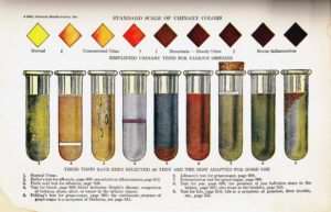 Standard Scale of Urinary Colors