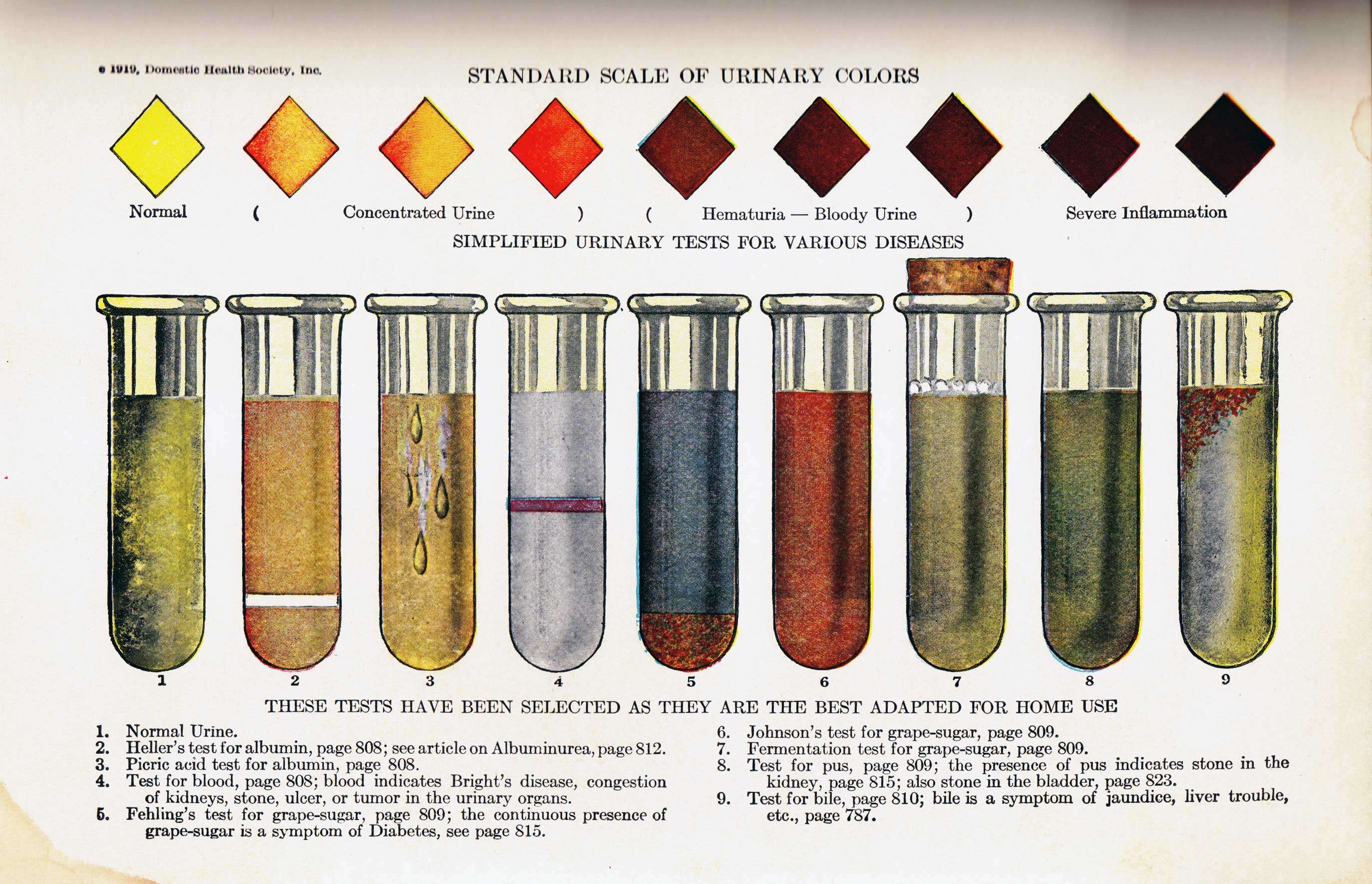 Standard scaling. Normal urine Test. Шкала цветов судебная медицина. Urine luck. Standard Scale.