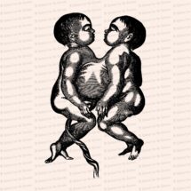 Vintage Edwardian Anatomical Clipart | Antique Fetal Omphalopagus Conjoined Twins | Siamese Twins SVG PNG JPG